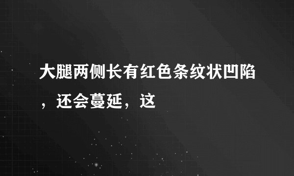 大腿两侧长有红色条纹状凹陷,还会蔓延,这