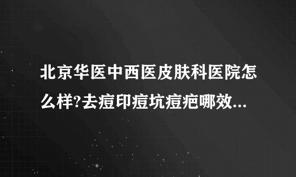 北京华医中西医皮肤科医院怎么样?去痘印痘坑痘疤哪效果比较好