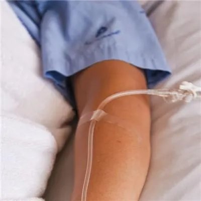 如何治疗胰腺癌好