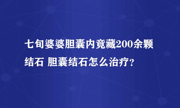 七旬婆婆胆囊内竟藏200余颗结石 胆囊结石怎么治疗?