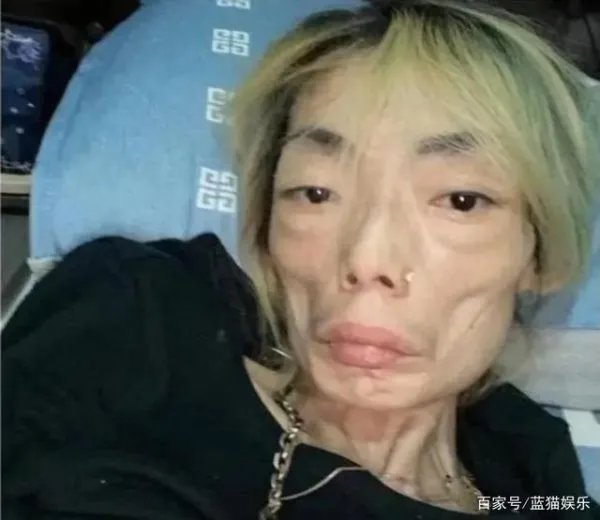 8年后由花容月貌变得骨瘦如柴