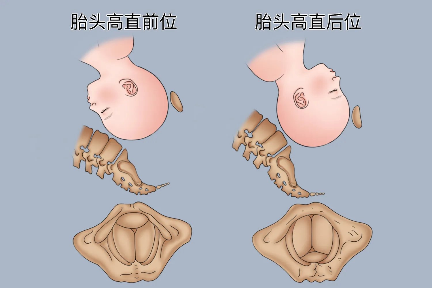 枕直前胎位图