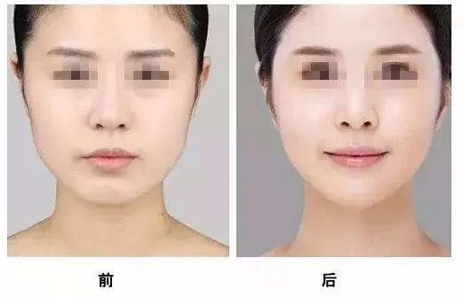 美容棒可以瘦脸吗