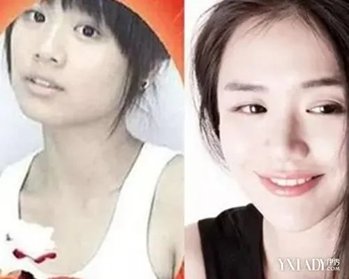 马思纯整容前图片疑曝光盘点马思纯出道以来的照片