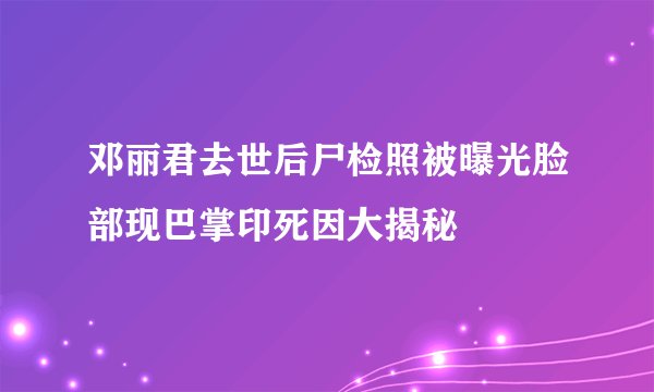 邓丽君去世后尸检照被曝光脸部现巴掌印死因大揭秘