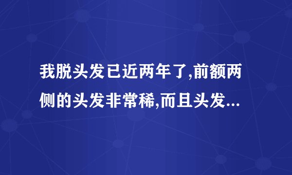 我脱头发已近两年了,前额两侧的头发非常稀,而且头发经常很油腻,什么霸王,索芙特等都用过,但是没有效果..
