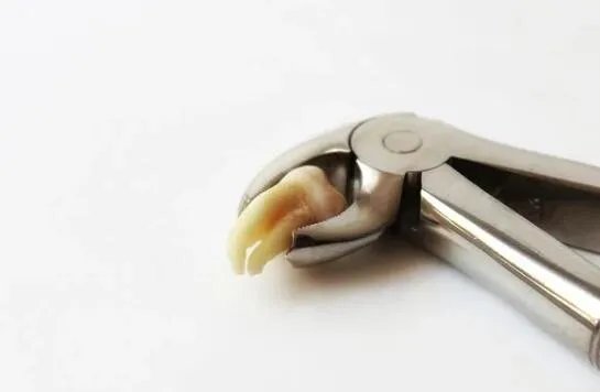 嘴里长了智齿一定要拔掉吗 长智齿是必须要拔的吗可以不拔吗