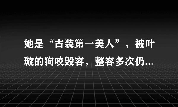 她是“古装第一美人”，被叶璇的狗咬毁容，整容多次仍翻不了身