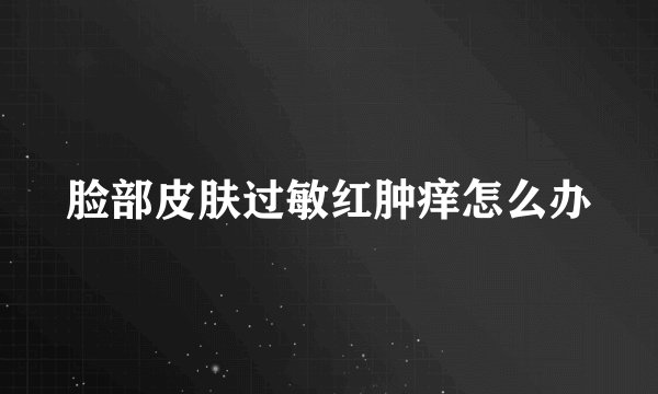 脸部皮肤过敏红肿痒怎么办