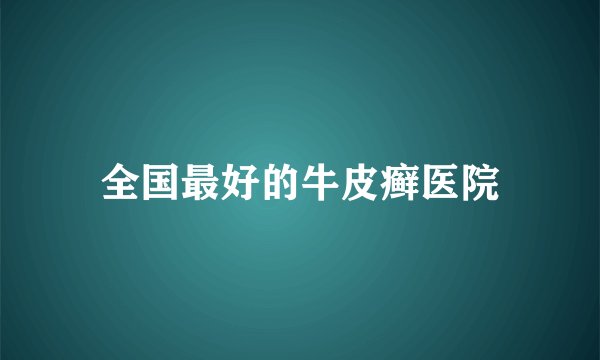 全国最好的牛皮癣医院