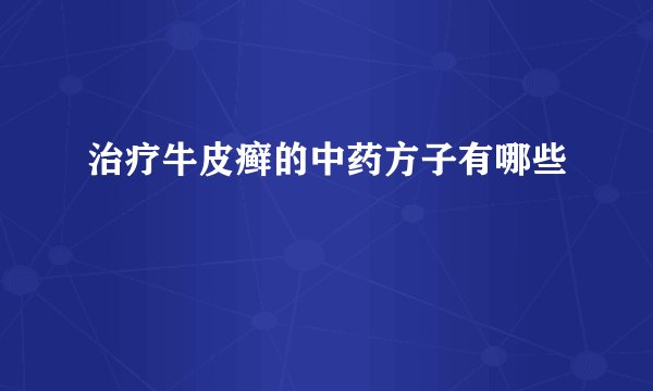 治疗牛皮癣的中药方子有哪些