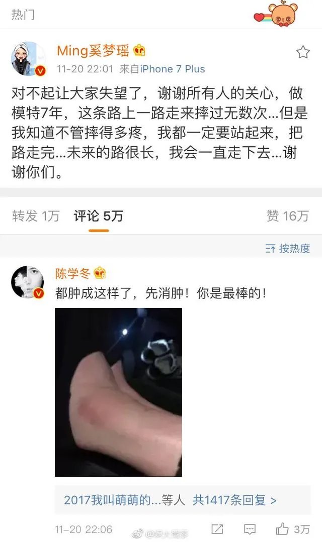 怎么看待奚梦瑶维密秀摔倒以及她的微博回应?