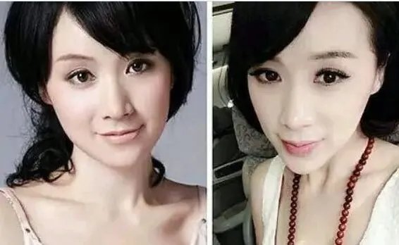姚芊羽,真的整容了吗?
