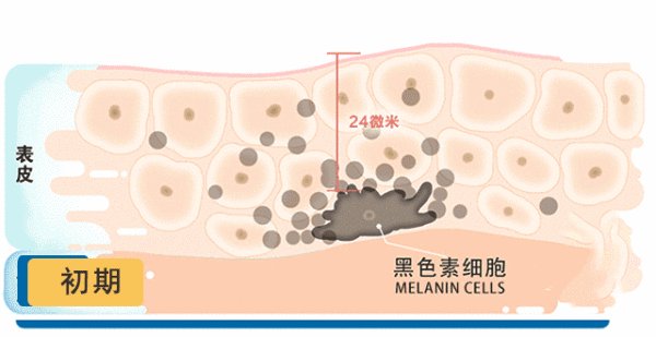 兰蔻淡斑精华有用吗?皮肤干的能用吗?