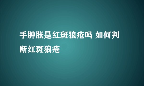 手肿胀是红斑狼疮吗 如何判断红斑狼疮