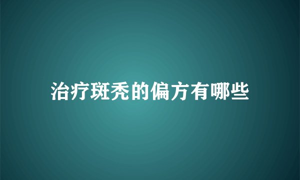 治疗斑秃的偏方有哪些