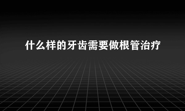 什么样的牙齿需要做根管治疗