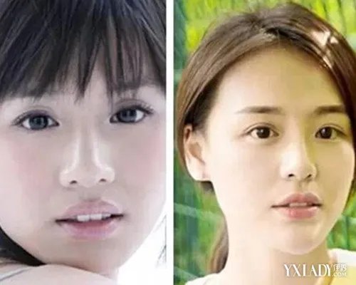 马思纯整容前图片疑曝光盘点马思纯出道以来的照片
